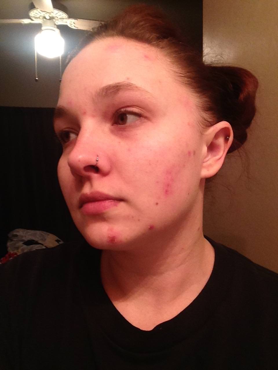 Day 1