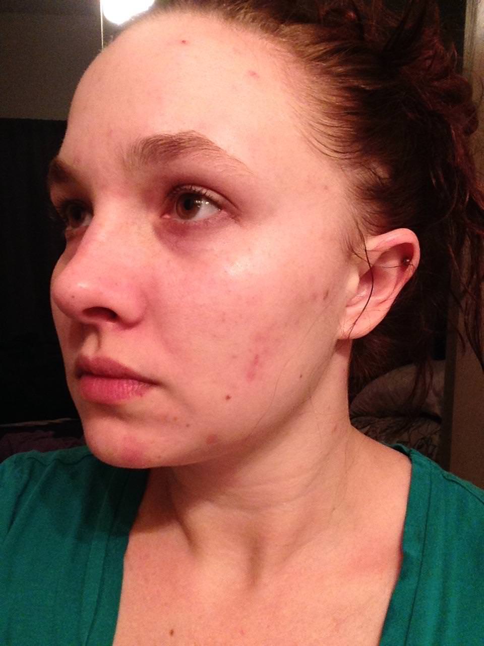 Day 5